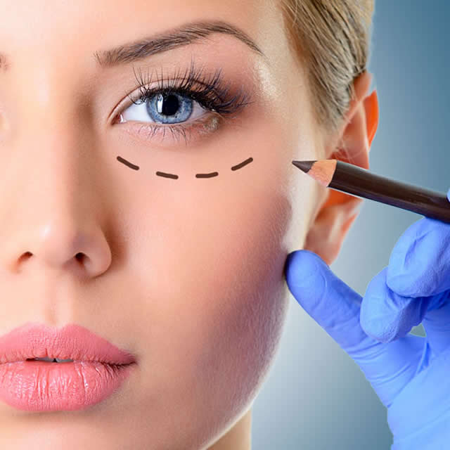 BLEFAROPLASTIA EN RIOBAMBA